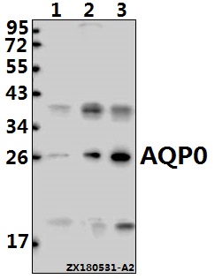 Western blot (WB) analysis of AQP0 (C144) pAb at 1:500 dilution
Lane1:THP-1 whole cell lysate(40ug)
Lane2:L02 whole cell lysate(40ug)
Lane3:C6 whole cell lysate(40ug)