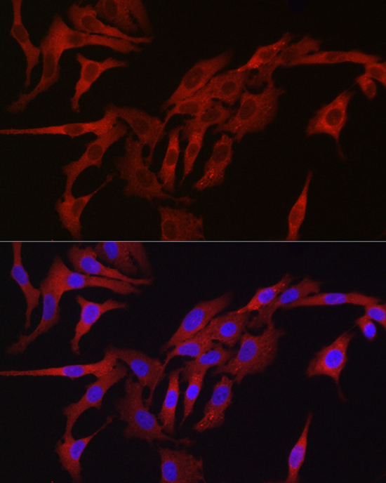 a00666 tmprss2 primary antiboties if testing 4