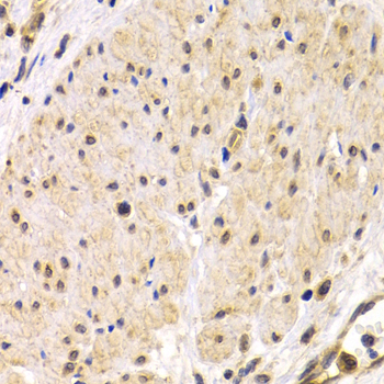 a00666 tmprss2 primary antiboties ihc testing 2