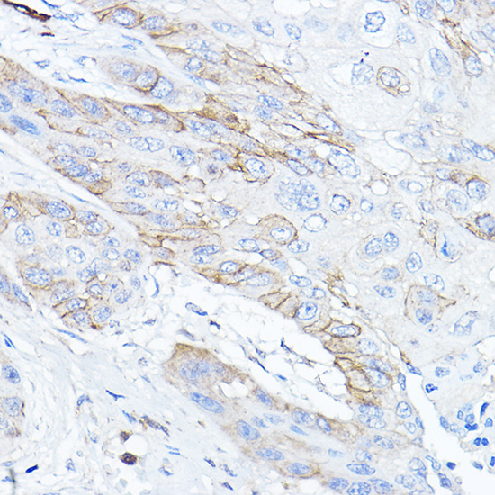 a00666 tmprss2 primary antiboties ihc testing 3