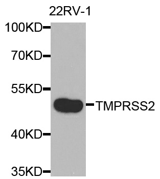 a00666 tmprss2 primary antiboties wb testing 1