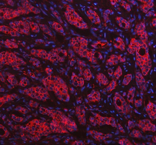 IF analysis of HPRT1 using anti-HPRT1 antibody (A00668-1)