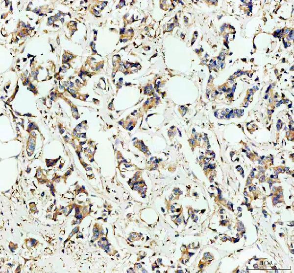 IHC analysis of HPRT1 using anti-HPRT1 antibody (A00668-1)
