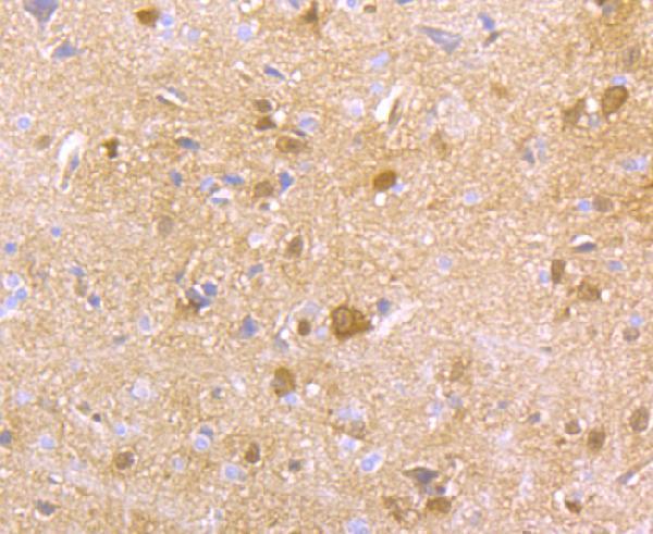 Immunohistochemical analysis of paraffin-embedded rat brain tissue using anti-HPRT antibody