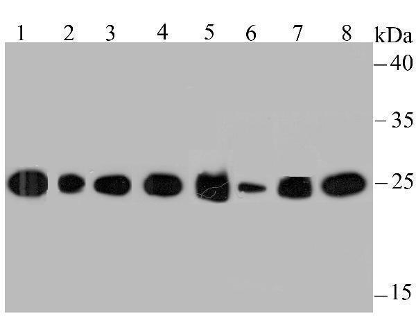Western blot analysis of HPRT on different lysates using anti-HPRT antibody at 1/500 dilution