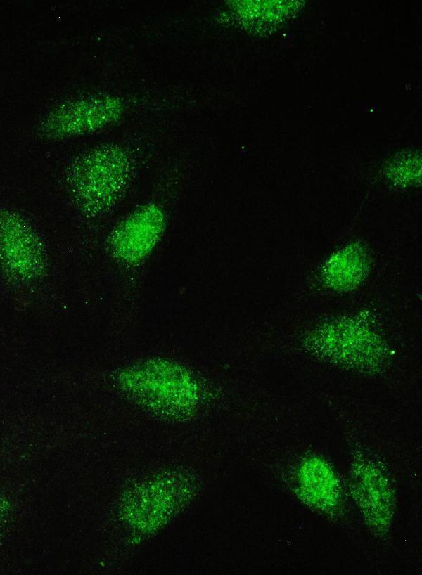 a00669 1 pax5 primary antibodies if testing 5