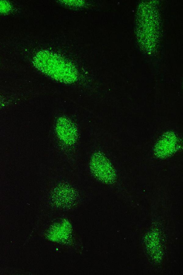 a00669 1 pax5 primary antibodies if testing 6