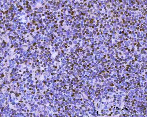  IHC analysis of BSAP/PAX5 using anti-BSAP/PAX5 antibody (A00669-2)