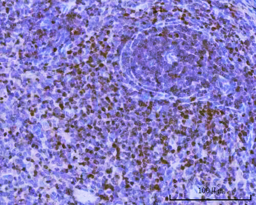 a00669 2 pax5 primary antibodies ihc testing 4