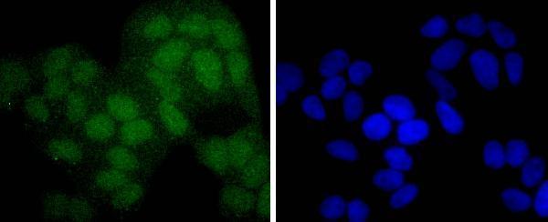 ICC staining PAX5 in Hela cells (green)