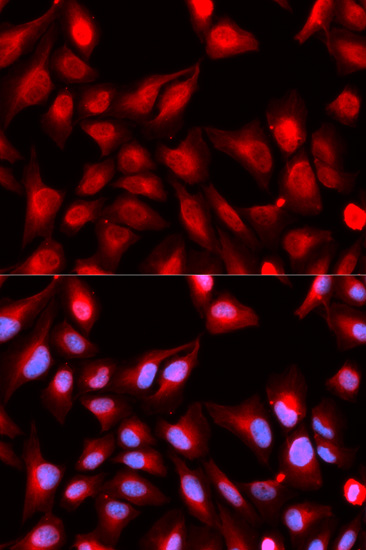 Immunofluorescence analysis of U2OS cells, using p68 RNA Helicase polyclonal antibody