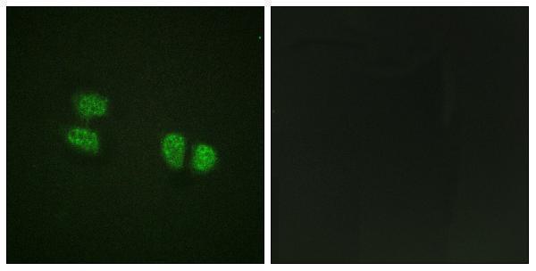 Immunofluorescence analysis of HeLa cells, using DDX5/DEAD-box Protein 5 (Phospho-Tyr593) Antibody