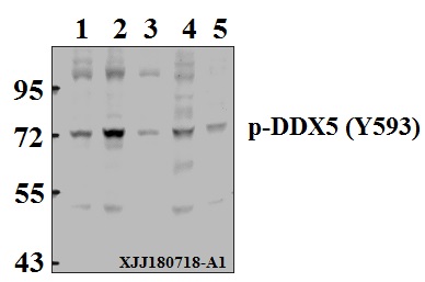 Western blot (WB) analysis of p68 RNA Helicase (phospho-Y593) polyclonal antibody at 1:500 dilution
Lane1:MCF-7 whole cell lysate(40µg)
Lane2:A375 whole cell lysate(40µg)
Lane3:U-87MG whole cell lysate(40µg)
Lane4:CT-26 whole cell lysate(40µg)
Lane5:C6 whole cell lysate(40µg)