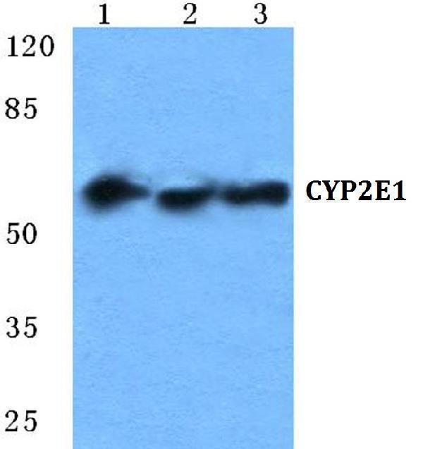 a00672 2 cyp2e1 primary antiboties wb testing 1