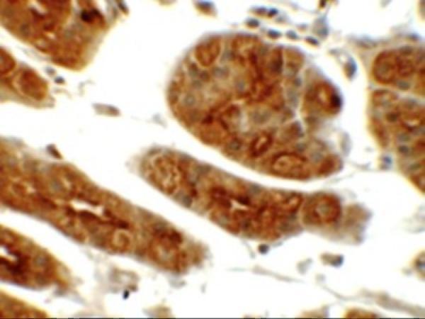 a00673 1 sgk1 primary antibodies ihc testing 2