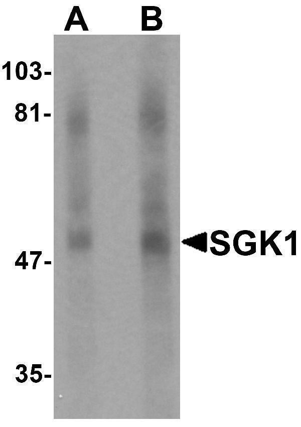 a00673 1 sgk1 primary antibodies wb testing 1