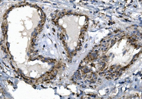  IHC analysis of SGK1 using anti-SGK1 antibody (A00673-2)