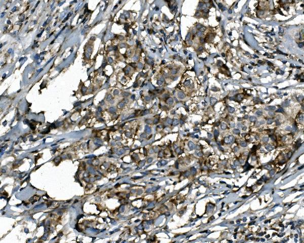  IHC analysis of SGK1 using anti-SGK1 antibody (A00673-2)