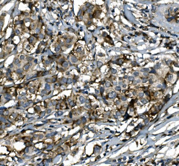 a00673 2 sgk1 primary antibodies ihc testing 4