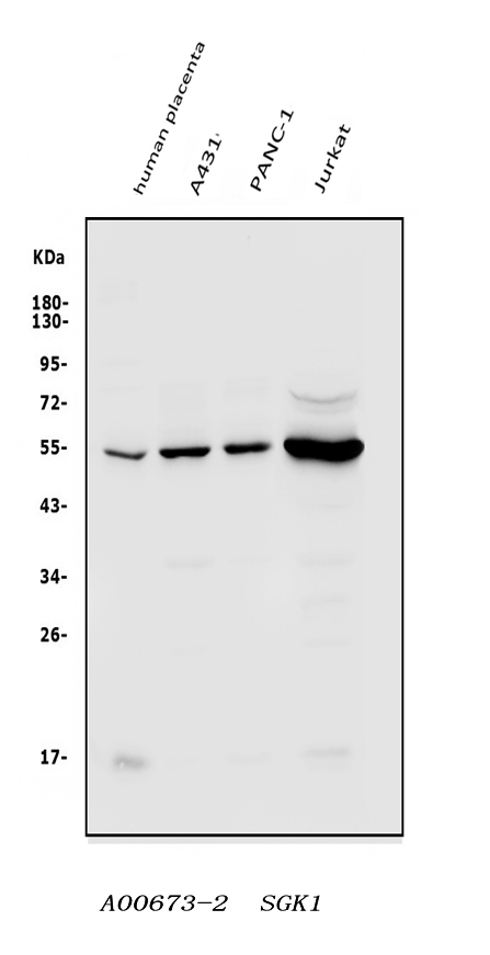  Western blot analysis of SGK1 using anti-SGK1 antibody (A00673-2)