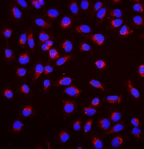 a00673 sgk1 primary antibodies if testing 1