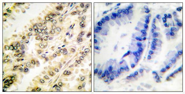a00673s422 sgk1 primary antibodies ihc testing 4
