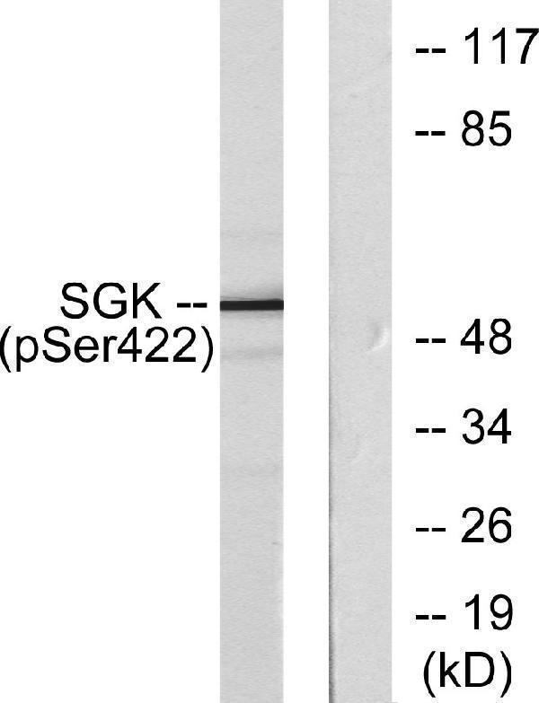 a00673s422 sgk1 primary antibodies wb testing 2