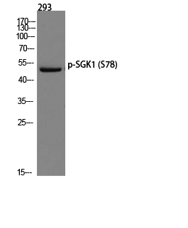 Western blot analysis of 293 using p-SGK1 (S78) antibody