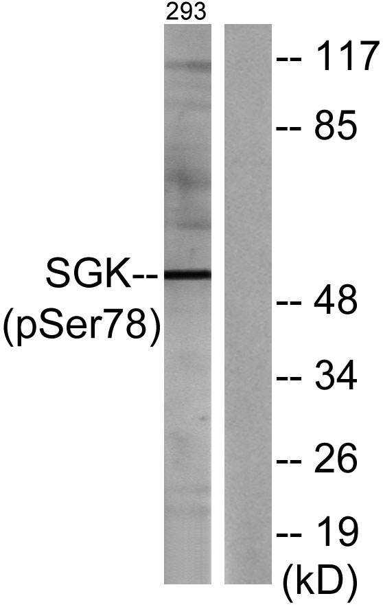 Western blot analysis of lysates from 293 cells treated with UV 15