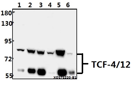 Western blot (WB) analysis of TCF-4/12 (S616) pAb at 1:500 dilution
Lane1:SGC7901 whole cell lysate(20ug)
Lane2:HepG2 whole cell lysate(40ug)
Lane3:Jurkat whole cell lysate(40ug)
Lane4:A549 whole cell lysate(40ug)
Lane5:PMVEC whole cell lysate(40ug)
Lane6:AML-12 whole cell lysate(40ug)