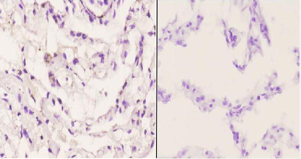 a00675 adrb1 primary antiboties ihc testing 2