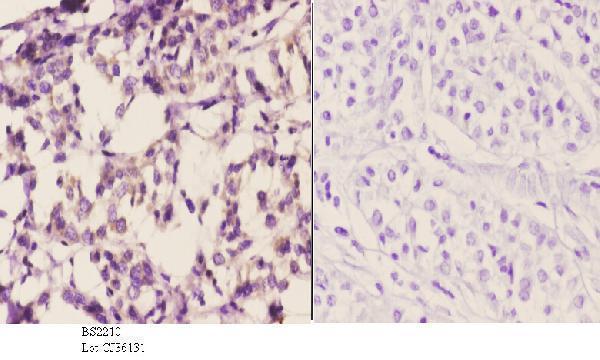 a00675 adrb1 primary antiboties ihc testing 3