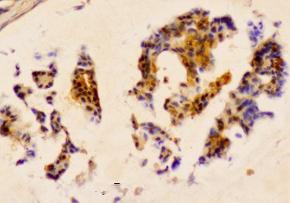 a00676s78 hspb1 primary antiboties ihc testing 2