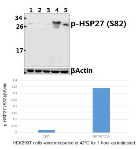 Western blot (WB) analysis of HSP27 (phospho-S82) pAb at 1:500 dilution
Lane1:A375 whole cell lysate
Lane2:SGC7901 whole cell lysate
Lane3:HEK293T whole cell lysate
Lane4:HEK293T transfected with pCDNA3