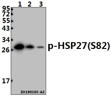 Western blot (WB) analysis of p-HSP27(S82) pAb at 1:500 dilution
Lane1:HepG2 whole cell lysate(40ug)
Lane2:SK-OVCAR3 whole cell lysate(40ug)
Lane3:A375 whole cell lysate(40ug)