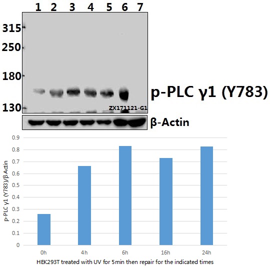 Western blot (WB) analysis of p-PLC γ1 (Y783) pAb at 1:500 dilution
Lane1:HEK293T whole cell lysate(40ug)
Lane2:HEK293T treated with UV for 5 minutes then repair for 4 hours whole cell lysate(40ug)
Lane3:HEK293T treated with UV for 5 minutes then repair for 6 hours whole cell lysate(40ug)
Lane4:HEK293T treated with UV for 5 minutes then repair for 16 hours whole cell lysate(40ug)
Lane5:HEK293T treated with UV for 5 minutes then repair for 24 hours whole cell lysate(40ug)
Lane6:C6 whole cell lysate(40ug)
Lane7:The Kidney tissue lysate of Mouse(40ug)