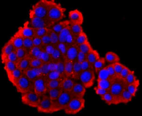ICC staining GLP1 in PC-12 cells (red)