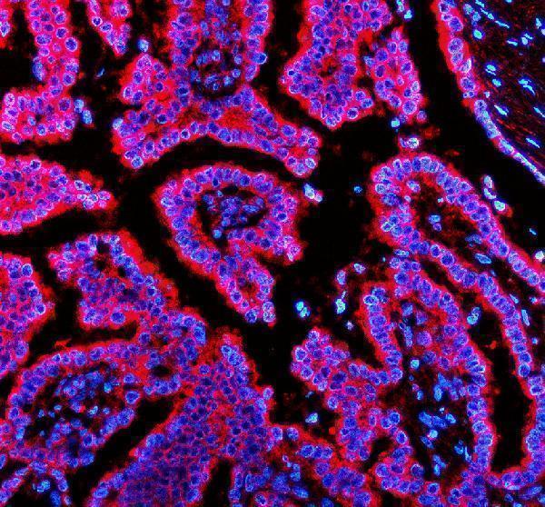 a00679 1 trio primary antibodies if testing 1