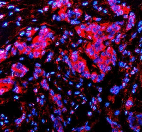 a00679 1 trio primary antibodies if testing 2