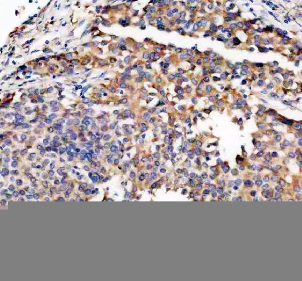 a00679 1 trio primary antibodies ihc testing 1