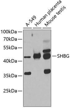 Western blot analysis of extracts of various cell lines, using SHBG antibody  at 1:1000 dilution