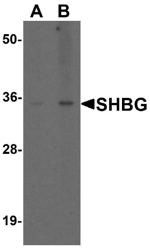 Western blot analysis of SHBG in human liver tissue lysate with SHBG antibody at (A) 1 and (B) 2 μg/ml