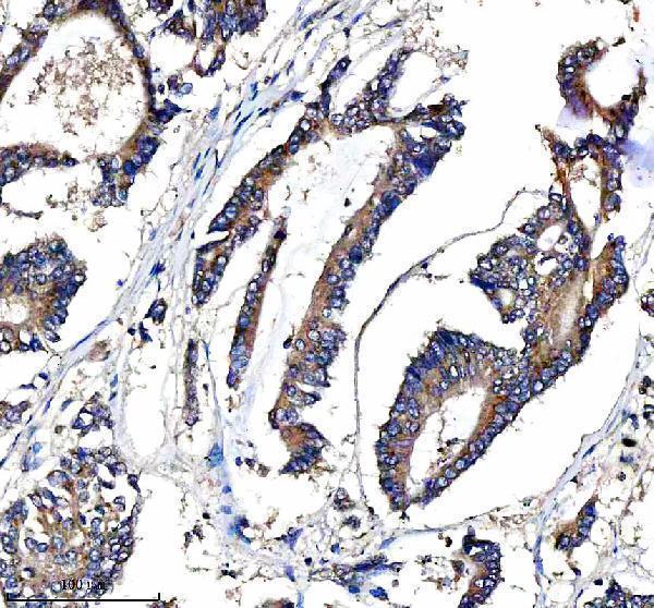  IHC analysis of IRE1/ERN1 using anti-IRE1/ERN1 antibody (A00683-2)