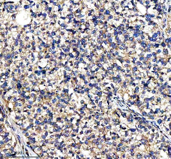 a00683 2 ire1 ern1 primary antibodies ihc testing 4