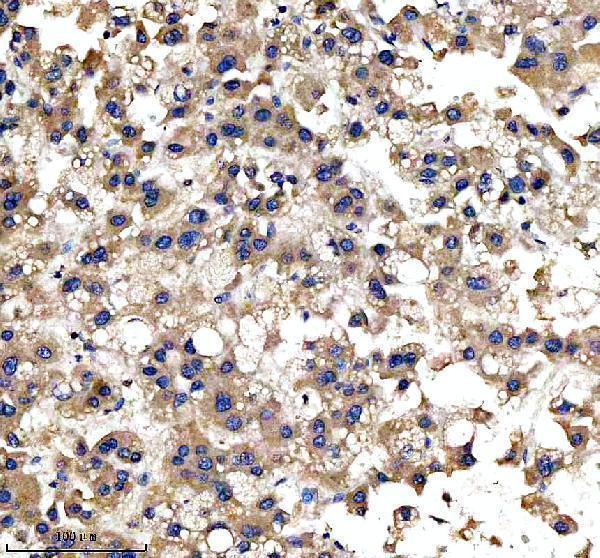 a00683 2 ire1 ern1 primary antibodies ihc testing 6