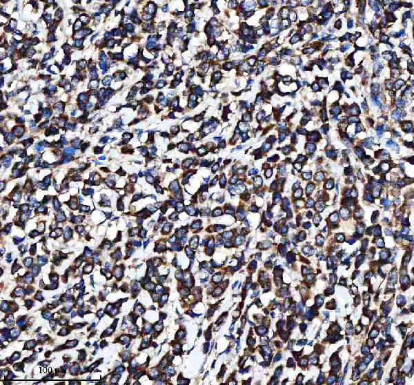 a00683 2 ire1 ern1 primary antibodies ihc testing 7