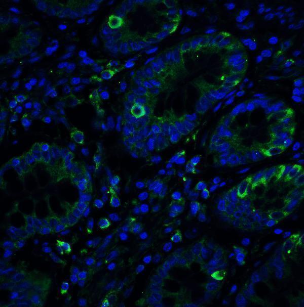 a00683 ern1 primary antibodies if testing 7