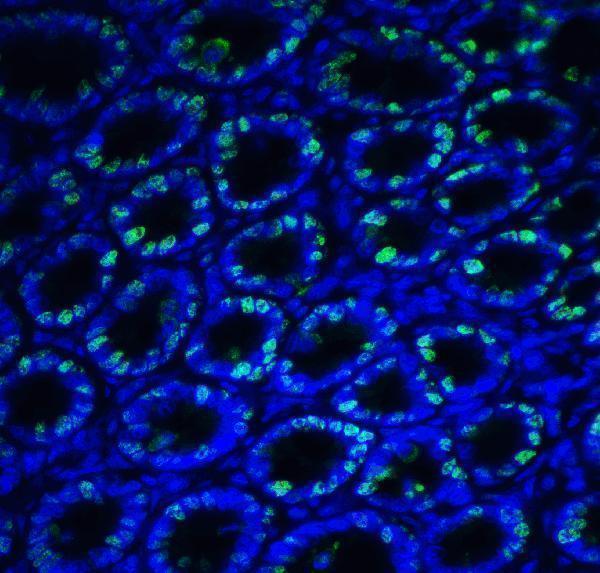 a00683 ern1 primary antibodies if testing 9