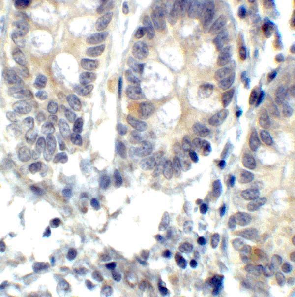 a00683 ern1 primary antibodies ihc testing 8