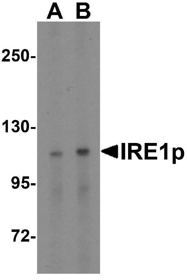 a00683 ern1 primary antibodies wb testing 4